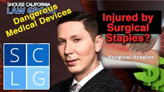 Surgical staples lawsuits -- How to file a claim