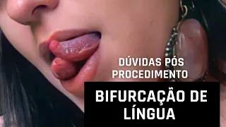 Bifurcação de língua (Dúvidas para Pós Procedimento).