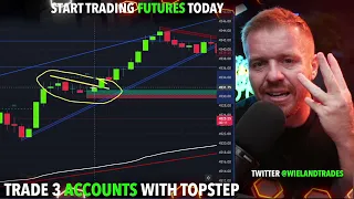 This Rule Solves Day Trading FOMO!