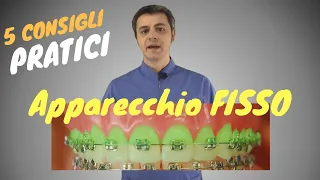 5 consigli pratici per sopravvivere con l'apparecchio fisso