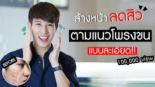 รักษาสิว สิวหาย ด้วยการล้างหน้าตามแนวโพรงขน 0 บาท พร้อมวิธีดูแนวขน! | เอามั้ยลองไมค์