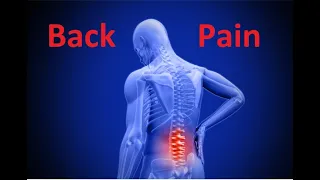 How to Manage Back Pain in the Clinic