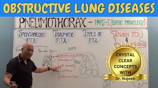 Obstructive Lung Diseases | COPD, Chronic Bronchitis, Asthma, Bronchiectasis & Emphysema🩺