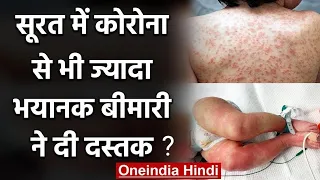 Gujarat के Surat में क्या Coronavirus से भी ज्यादा भयानक बीमारी आई सामने ? | वनइंडिया हिंदी