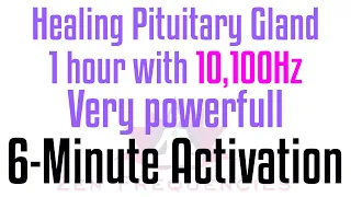 Pituitary Gland Healing with 10,100 Hertz Quantum Miracle Power FOR ANXIETY- WAIT TILL 6 Mins!