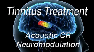 Tinnitus Treatment Using Acoustic Coordinated Reset Neuromodulation (ACRN)