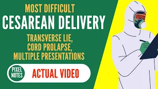 Cesarean Delivery | Transverse Lie | Cord Prolapse | Multiple Presentations