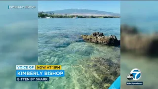 Shark attack: Glendale woman bitten while vacationing in Hawaii | ABC7
