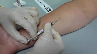 Tb Skin Test Placement