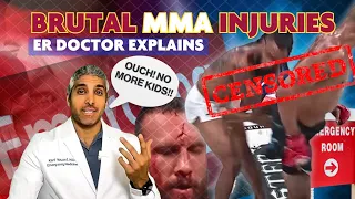 BRUTAL MMA LIFE CHANGING INJURIES -  - ER DOCTOR EXPLAINS