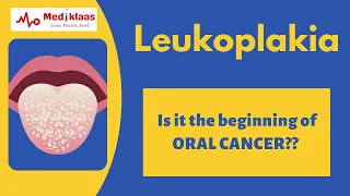 Leukoplakia l Precancerous lesions l Oral pathology l Mediklaas