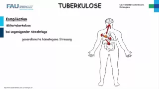 Pathologie ─ Tuberkulose