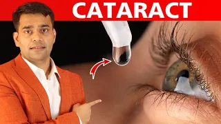 Eat This Every Day To Prevent Your Eyes From Cataract  - Dr. Vivek Joshi