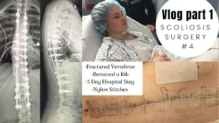 Scoliosis VLOG #1 | Surgery #4