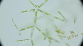 Antarctic Diatoms (80x) from McMurdo Sound Sea Ice Ceiling #2