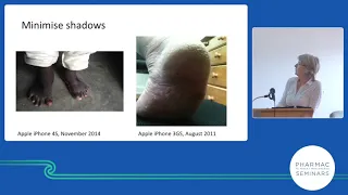 PHARMAC seminar: Dermatology update, E-Referrals part 2