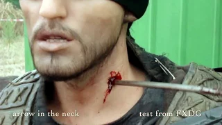 Arrow in the neck