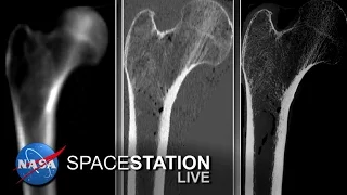 Space Station Live: A New Measure of Bone Strength