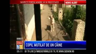 Copilul de 11 ani muscat de câine a ramas fara o ureche