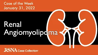 Case of the Week: Renal Angiomyolipoma