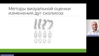 Сколиоз. Эффективный метод коррекции и лечения часть 2  Артемьев Павел Владимирович