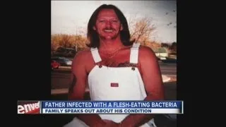 Colo. man with flesh-eating bacteria has long road ahead