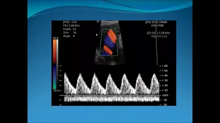 Obstetric Doppler Part 1