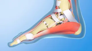 ¿Cuáles son las causas y tratamientos del dolor de talón?