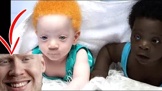 Do You Remember The Black Twins With Different Colors? See How They Have Changed.