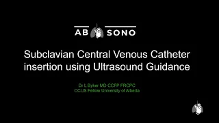 Ultrasound-guided subclavian venous access