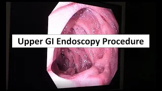 Upper GI Endoscopy Procedure in the ED