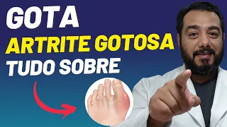 Gota (artrite gotosa): o que é, causas, sintomas, diagnóstico e tratamento | Dr. Victor Proença