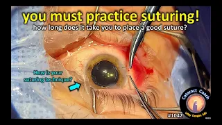 CataractCoach 1042: why eye surgeons must practice suturing!