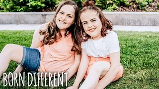 The Twins That Were Cut In Half | BORN DIFFERENT