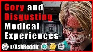 Doctors and Nurses reveal the most gory/disgusting experiences (r/AskReddit - Reddit Scary Stories)
