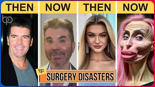 20 Times Plastic Surgery Went Horribly Wrong | You'll Never Realize
