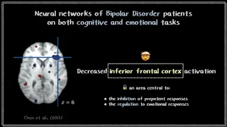 Bipolar Disorder and Creativity