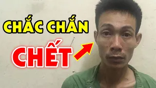 5 Nét Tướng Ở Người Chắc Chắn ĐOẢN MỆNH, Bệnh Tật Triền Miên, Xem Ngay Kẻo Muộn