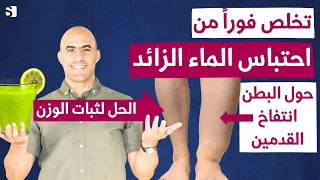 تخلص فورا من احتباس الماء حول البطن والجسم خلال ايام قليلة و بدون أدوية | ما هو المشروب السحري