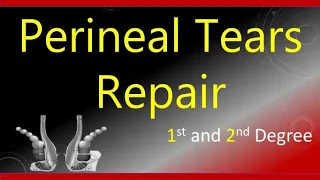 Perineal Tears Repair (First and Second-Degree) | TOACS / OSCE Station