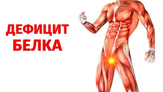 ПРИЗНАКИ ДЕФИЦИТА БЕЛКА В ОРГАНИЗМЕ