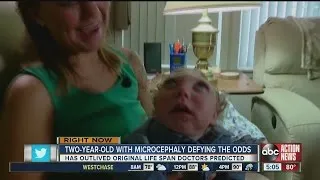 2-year-old with microcephaly defying the odds