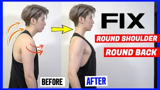 HOW: FIX Round Shoulder & Round Back in 1 week | 七天見效 告別虎背熊腰
