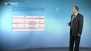 ECG  Clinical case examples and questions on tachy arrhythmias