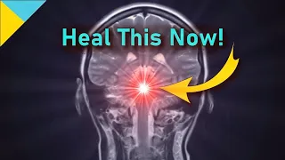 Strong PITUITARY GLAND Healing Tone ❯❯❯ 10500 Hz • Quantum Miracle Formula Frequency