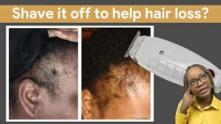 Should I shave my head if I have hair loss? | The answer may surprise you!