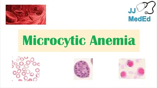 Microcytic Anemia & Causes (Iron Deficiency, Thalassemia, Anemia of Chronic Disease, Lead Poisoning)