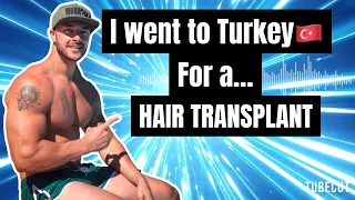 I Went To Turkey For A Hair Transplant @VeraClinic
