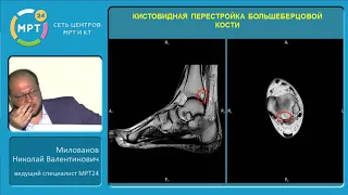 Дегенеративно-дистрофические заболевания голеностопного сустава