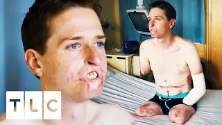 The Horrific Disease That Ate Away At This Man’s Face | Body Bizarre